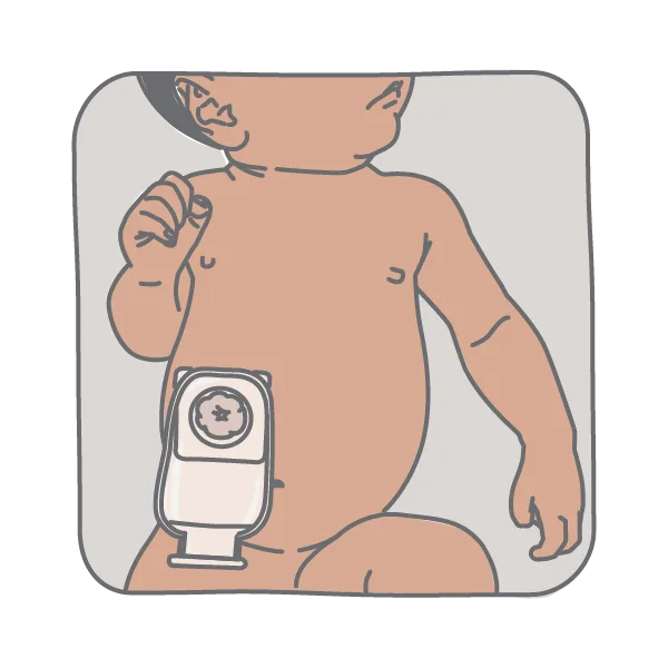 ostomy icon