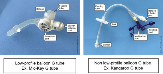 What is the best practice for changing a balloon Gastrostomy tube? picture10