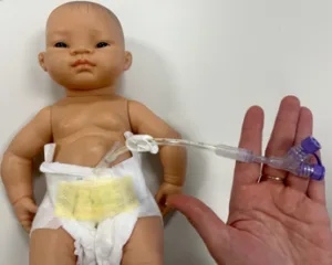 Gastrostomy Tube