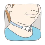 Tracheostomy 1 150x150 Png