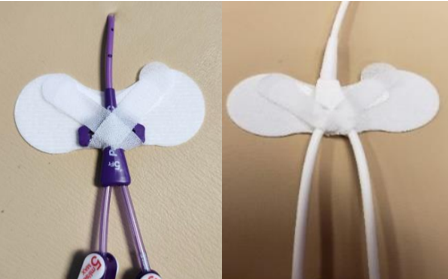 What is Clik-FIX® and how is it used to secure central venous access devices? Caption: Securement of a CVAD with wings (left) and securement of a double lumen CVAD without wings (right).