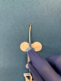 What is Clik-FIX® and how is it used to secure central venous access devices? Remove paper covering on adhesive patch and align the CVAD wings with the securement straps. Press the wings into the adhesive patch