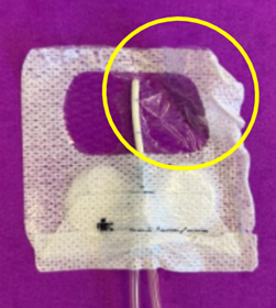 transparent window of primary dressing lifting on a CVAD