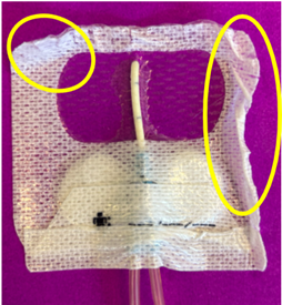 white borders of primary dressing lifting on a CVAD