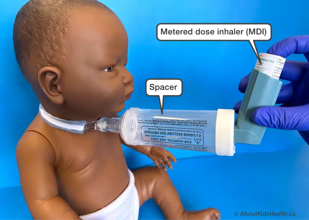 A RespiChamber spacer for a tracheostomy tube